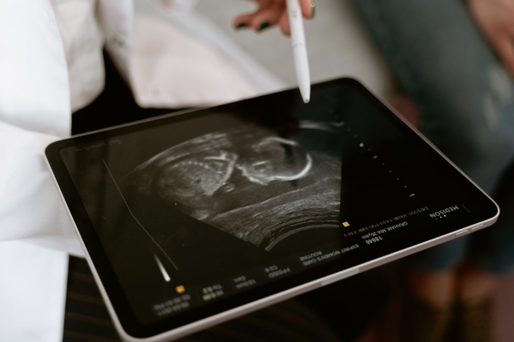 New medical device in sonography